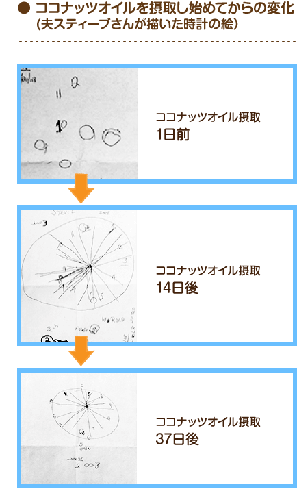 Mctサロン ケトン体と Mct 脳の代替エネルギーとして